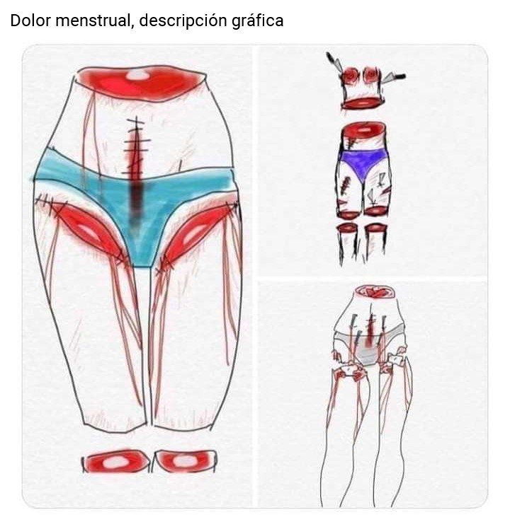 karo_bp's tweet photo. Vi esta imagen en Twitter y me causó profunda tristeza y preocupación. Quiero hablar de la #Endometriosis y espero que las mujeres que me siguen puedan darle rt a este hilo para que de a poco vaya conociendo su propio cuerpo. https://t.co/eTnrjTuTWL