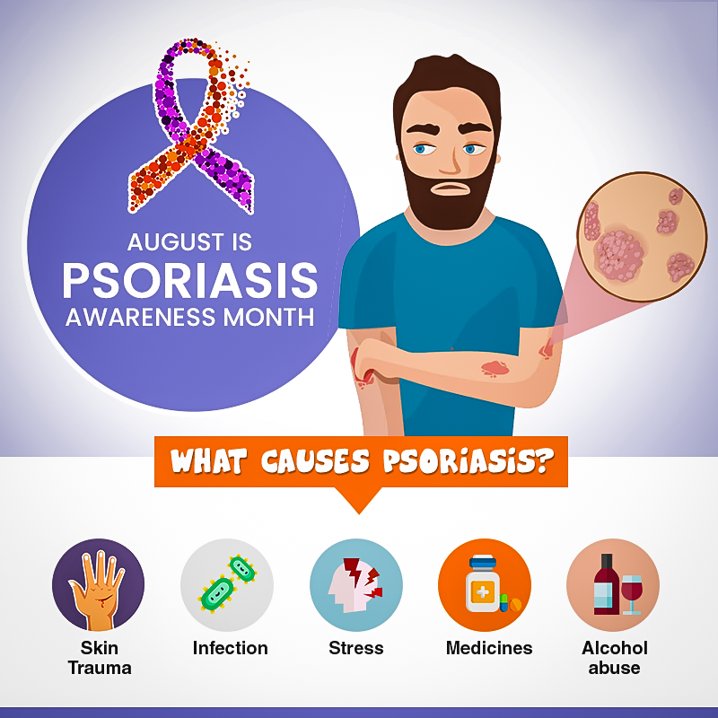 psoriasis and ivf