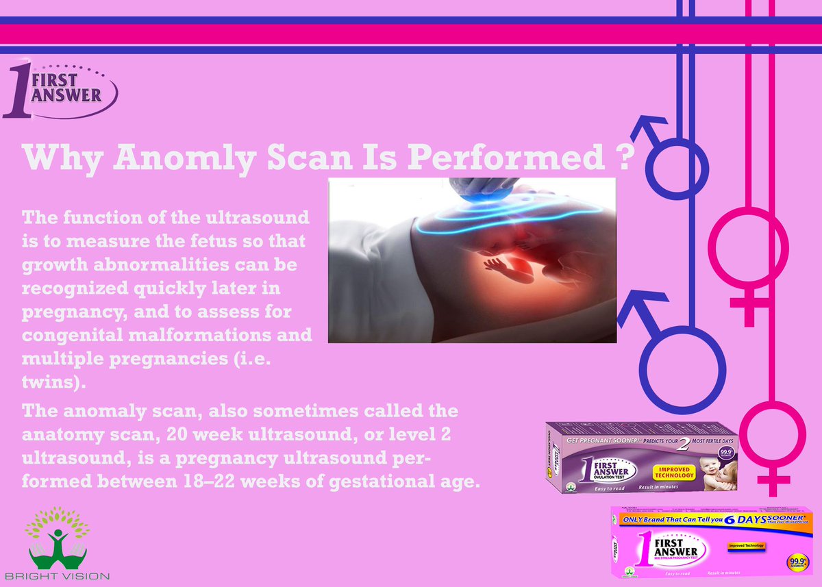 bvh_pk's tweet image. Is Anomly Scan Is Performed during pregnancy?
For more please like our page...
Need Right Answer.
Get First Answer..
Visit our shop: daraz.pk/shop/bright-vi… 
#Deepscan #SaveSpiderMan #6Indian