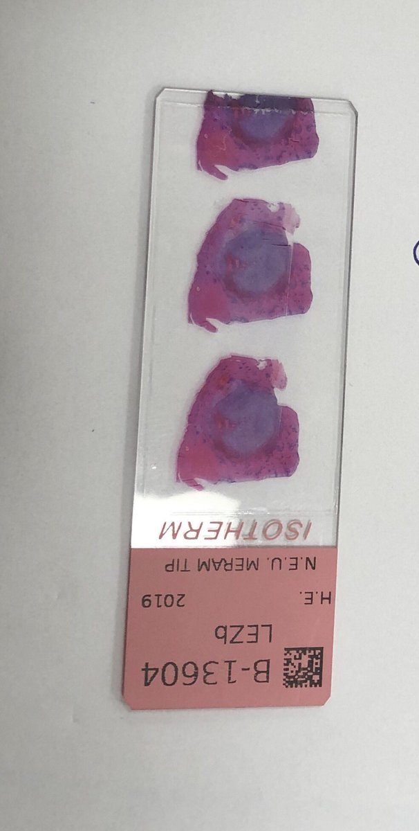 Pembeoltulu On Twitter Middle Aged Woman 15 Cm Liver - 