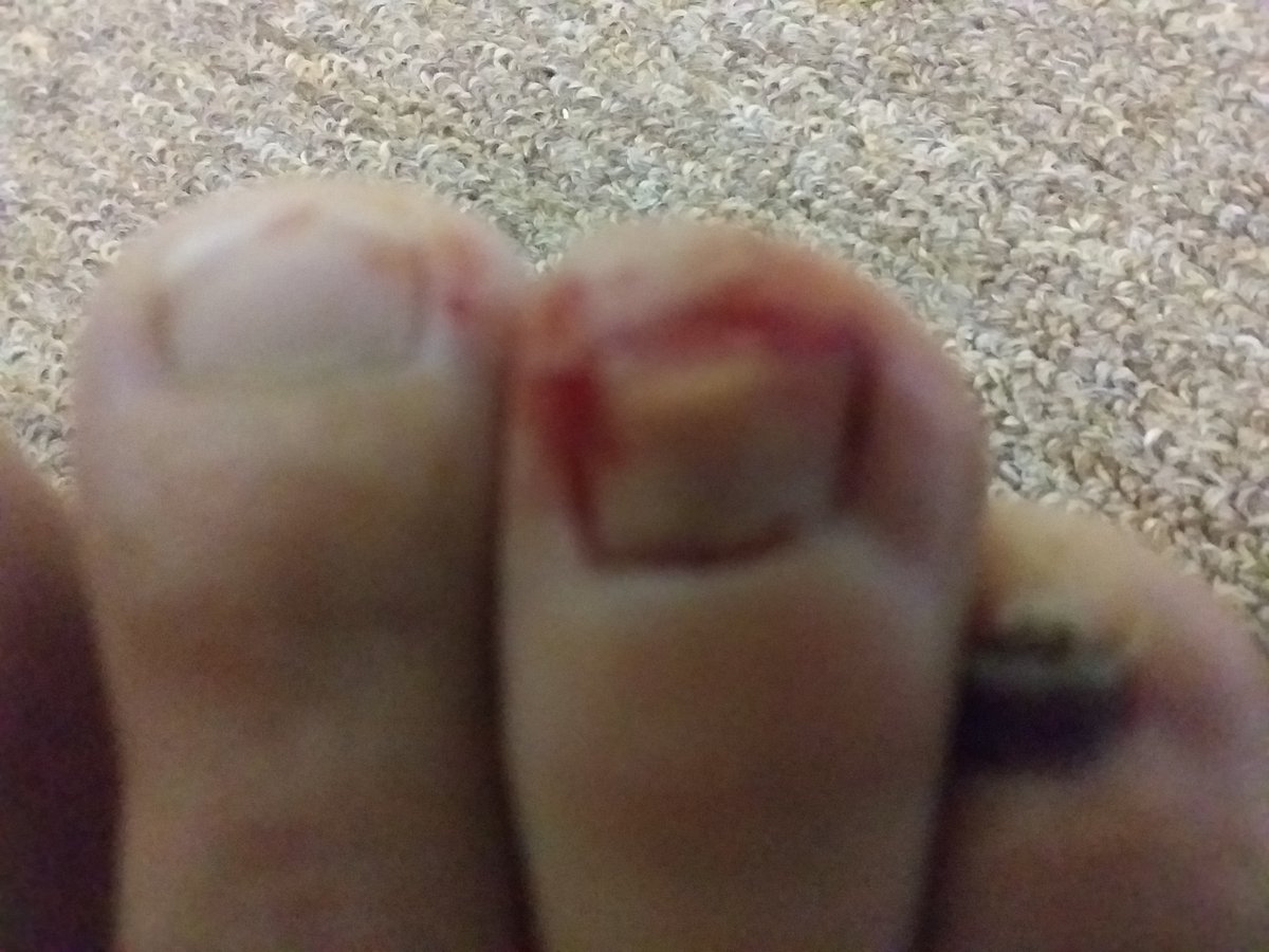 nicholasboyle79's tweet photo. #running #soretoes not the best photo and not the best run today https://t.co/Se4JRMNs6X