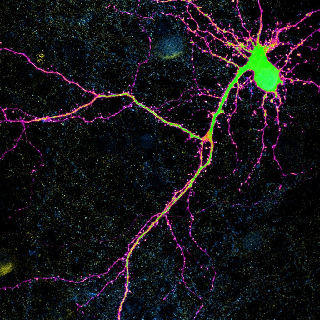 NCNDgroup_KCL's tweet image. Huge congratulations to our @in2scienceUK student Isra Albaghady for winning the @KCLWCIC imaging contest with her beautiful Fruity Pebbles neuron! #getin2science #sciart