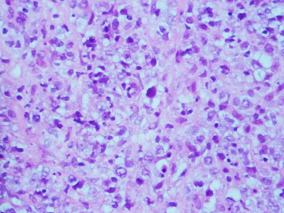 Siba El Hussein, MD tweet media