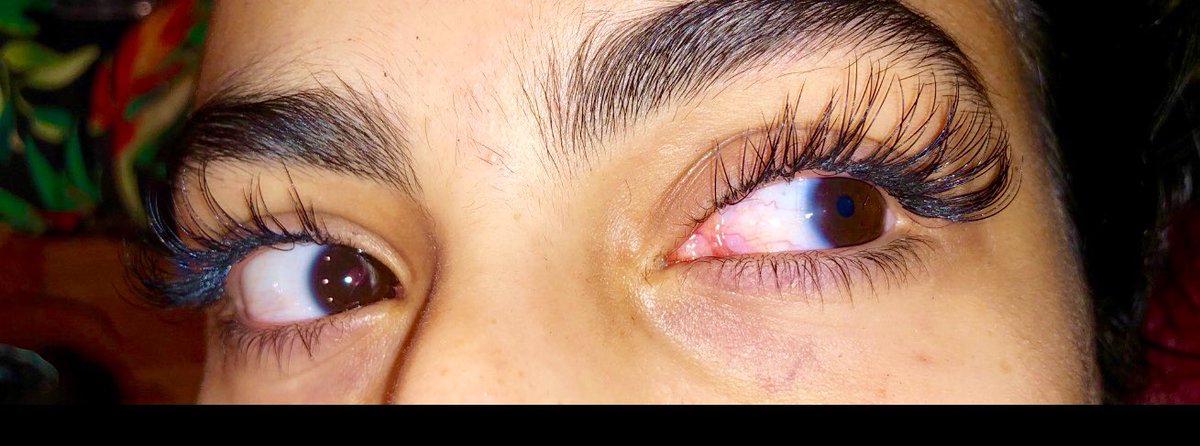 AshG103's tweet image. Ladies Come Support Me I’m A Certified Lash Tech Located In CHICAGO Doin ‘ Full Sets For Only $55 A Simple RT Could Help Me Build My Clientele #FlossyWinks #ChicagoLashTech