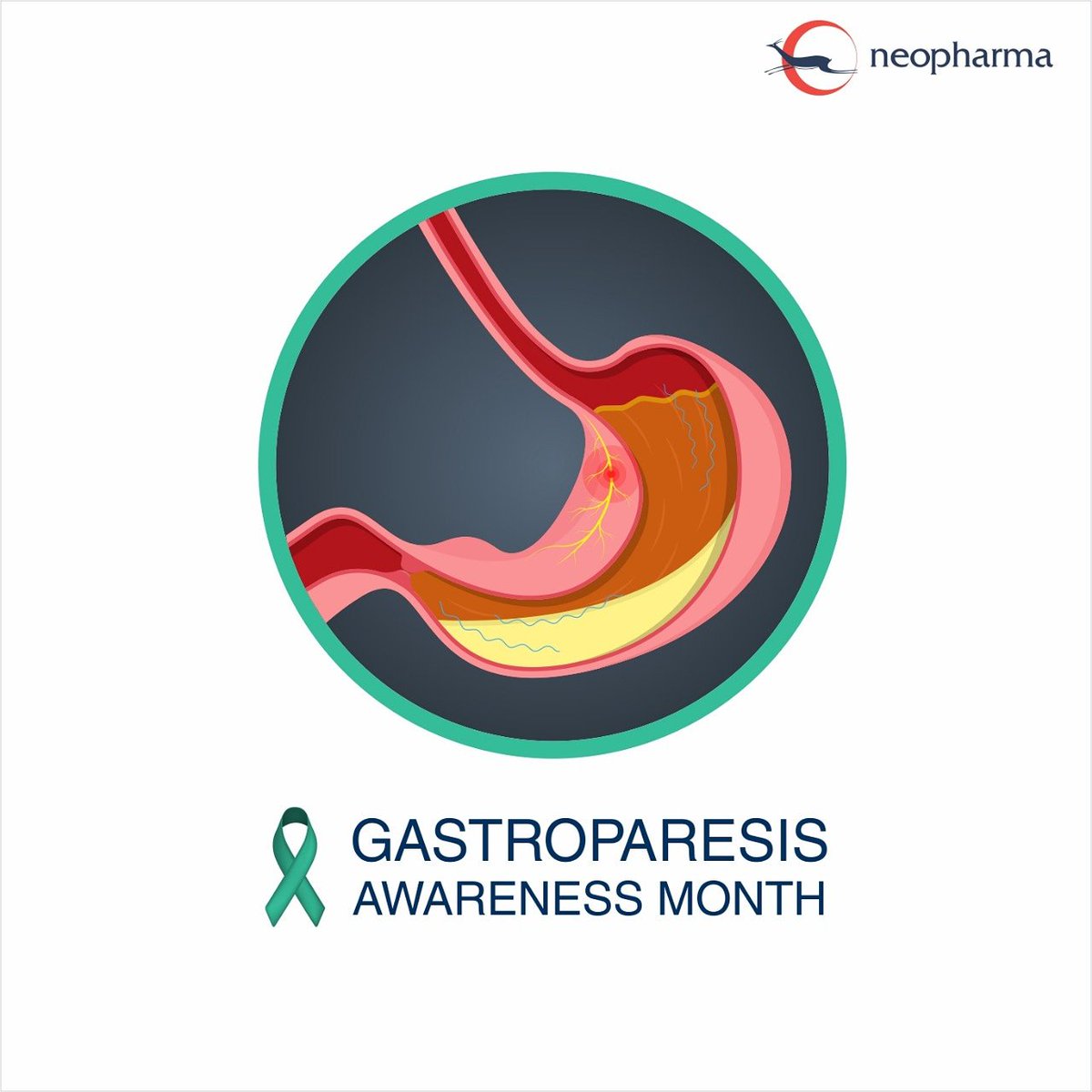 Neopharmaglobal's tweet photo. Gastroparesis Awareness Month. Gastroparesis, also known as delayed gastric emptying, is a chronic condition that affects digestion. Know more: https://t.co/F0QkEqpvFp

#GastroparesisAwarenessMonth #Gastroparesis #DigestiveTractParalysis #Pharmaceutical #Neopharma https://t.co/3QQFTfcigF