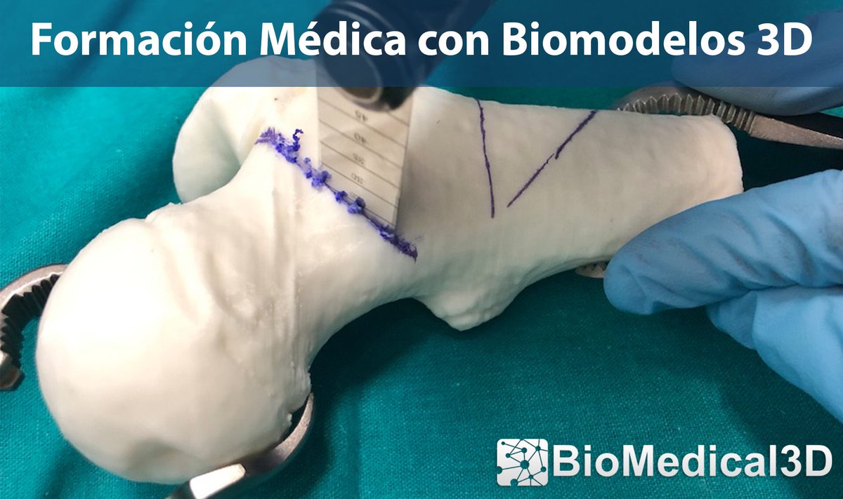 biomedical3d's tweet photo. 5 ventajas de los biomodelos 3D en cursos de formación médica 🏥
1️⃣ Facilitan curva de aprendizaje 📈
2️⃣ Personalizables al curso 🎭
3️⃣ Permiten reproducir la técnica 🦴🔨
4️⃣ Fácilmente manipulables ✍🏻
5️⃣ Económicos 💰💸

https://t.co/dDk5q5gsBr

#3dprinting #biomedical https://t.co/tTiYI2ismP