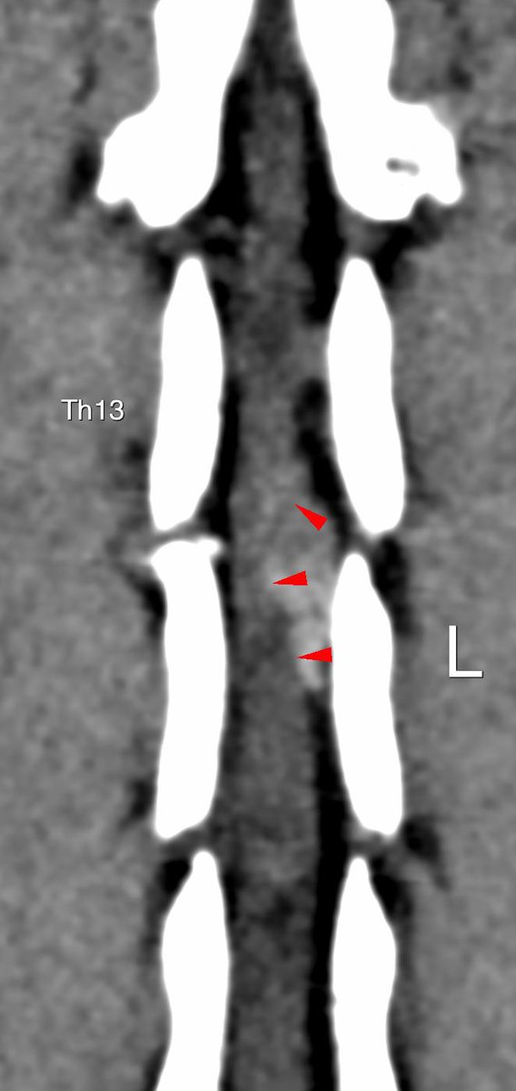 read toxoplasmosis: a comprehensive