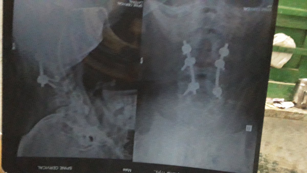 akshay_kumar00's tweet photo. @KTRTRS  @KTRoffice 
Hello Sir, I am Lalamgari Akshay Kumar,I am 19 years old from Hyderabad, and here to request you to please kindly assist me a financial help. I am suffering from 2016.
Looking forward to hear from you. https://t.co/UWbRGAEbUY