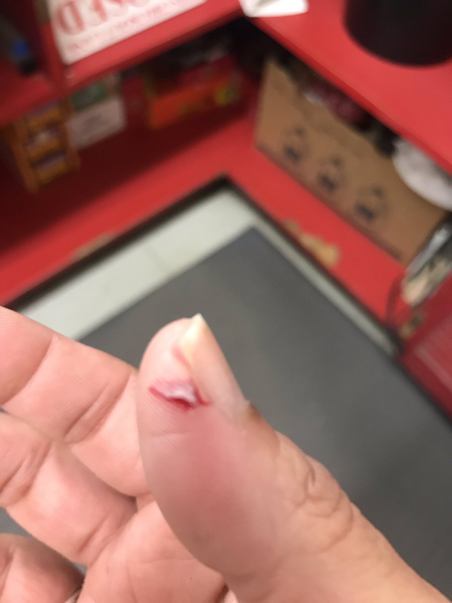 Gmh2972's tweet photo. @MichaelKors I’m so disappointed this keeps happening with tha back pocket logo , today I got hurt pretty bad https://t.co/CZ8LzWXcVm
