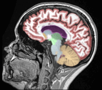 ProscanNaples's tweet photo. NeuroQuant is software that analyzes a brain MRI to improve early detection &amp; treatment of dementia, Alzheimer's disease, traumatic brain injury, multiple sclerosis &amp; epilepsy.  Proscan Imaging 3T MRI is the only center is SW FL performing this exam. For more info, call 598-0035. https://t.co/5967GKuGgK
