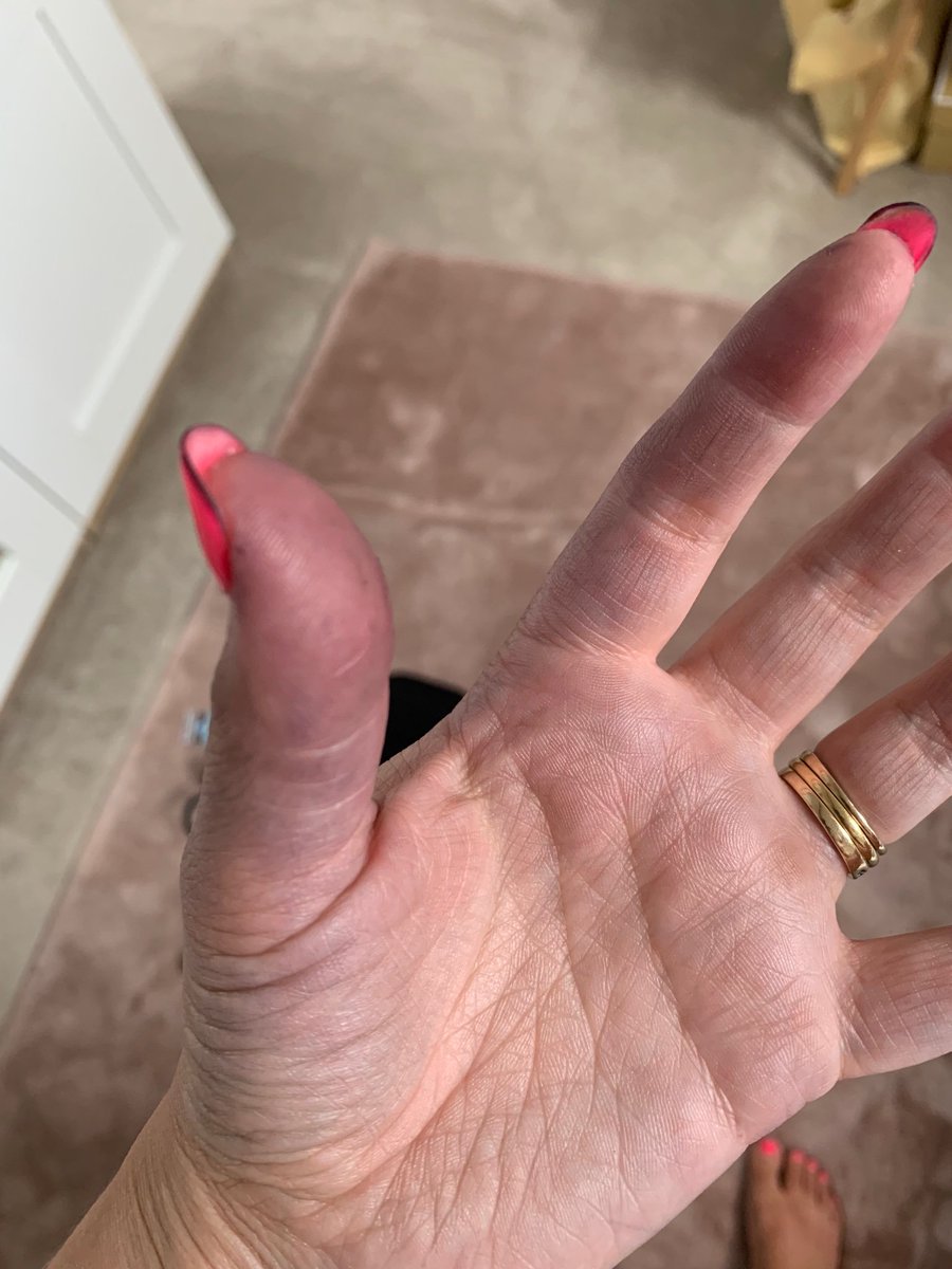 CLRiggott's tweet photo. @boohoo_cshelp  hi I’ve received my order today and everything fits great but after trying on my black co- ord on my hands and nails are covered in ink or dye. Is this normal as my nails are a mess https://t.co/SyTsO33VG9