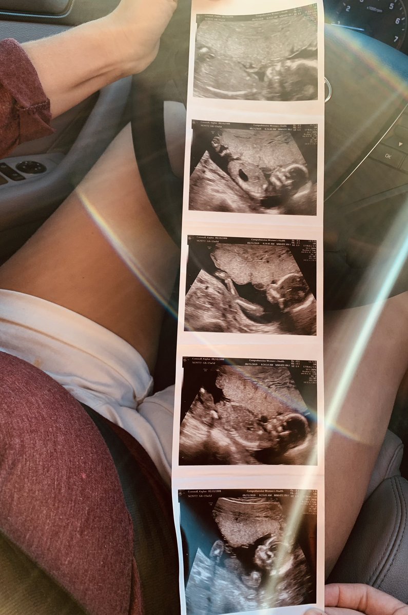 kaybug0810's tweet photo. Our blessing ❤️ https://t.co/ZPZZLRjE8M