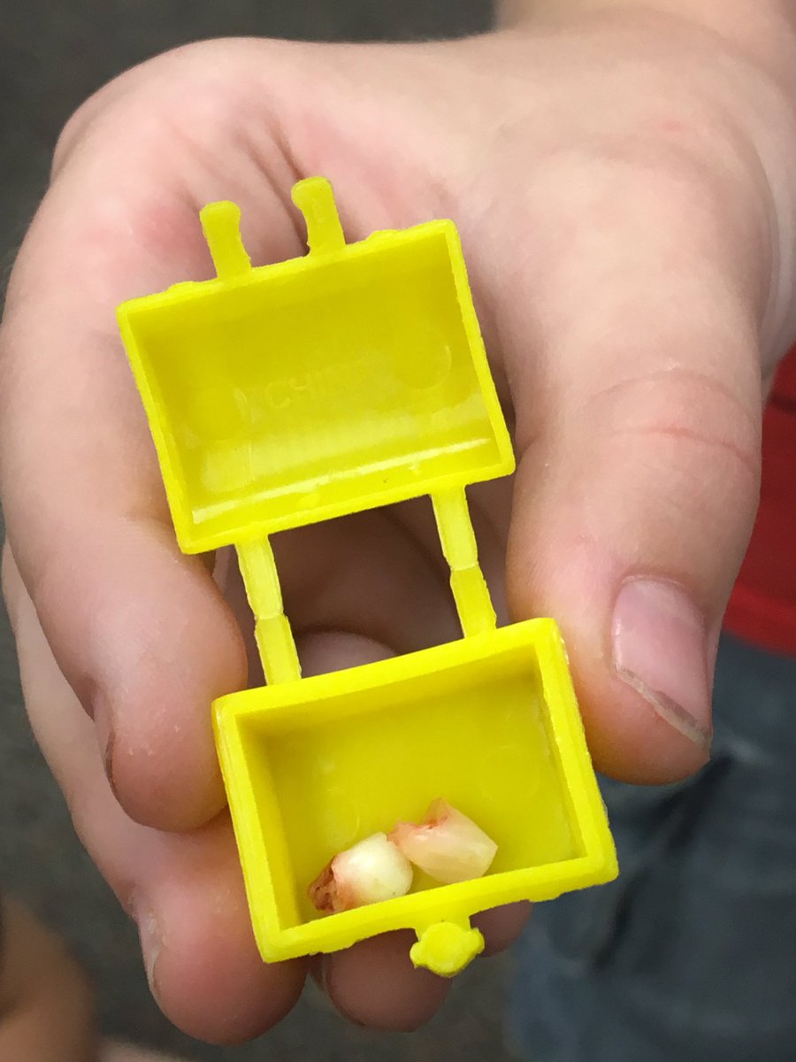J2LearningIsFun's tweet image. A Jaixen class record...never had a student lose two teeth in one day. Tooth Fairy better hit the ATM...