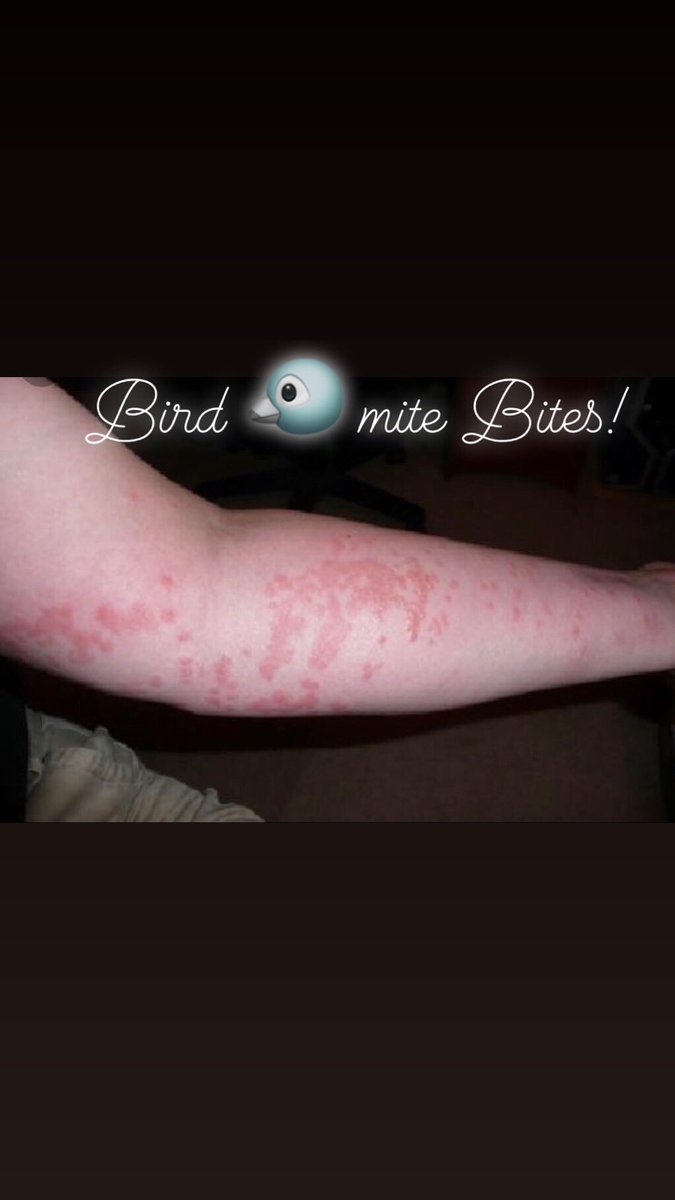 MariaMa40563270's tweet photo. Bird mites may infest homes in search of a blood-meal from humans. Bites from bird mites can cause severe irritation. #birdmitebites #birds #bugs #fleas #termites #mice  #ladybugstermiteandpestcontrol https://t.co/wwRDOKvZl8