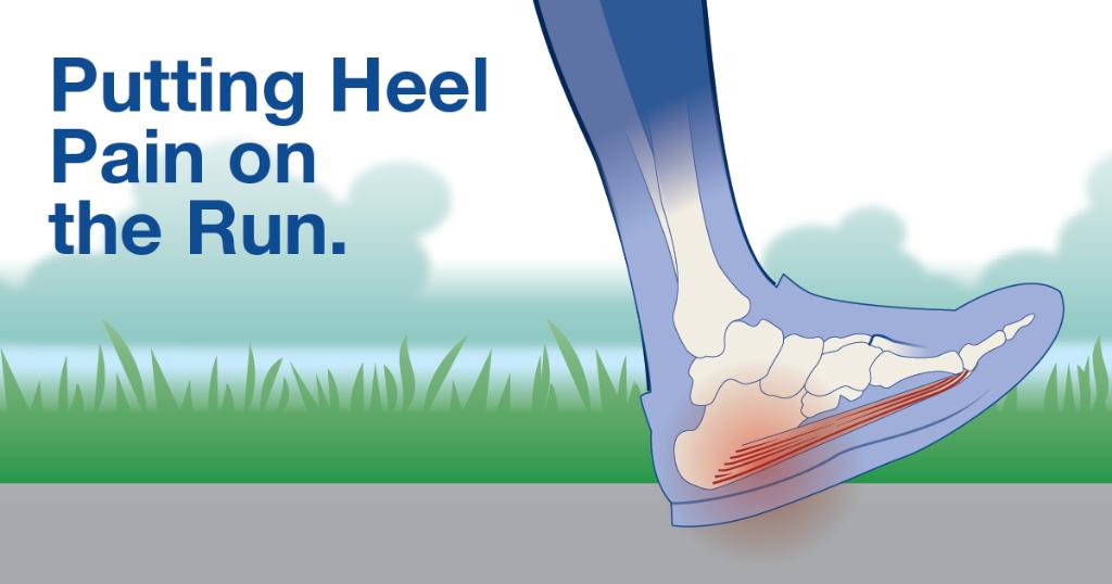 Bruised heel bone can be painful! Causes, Symptoms & Treatments