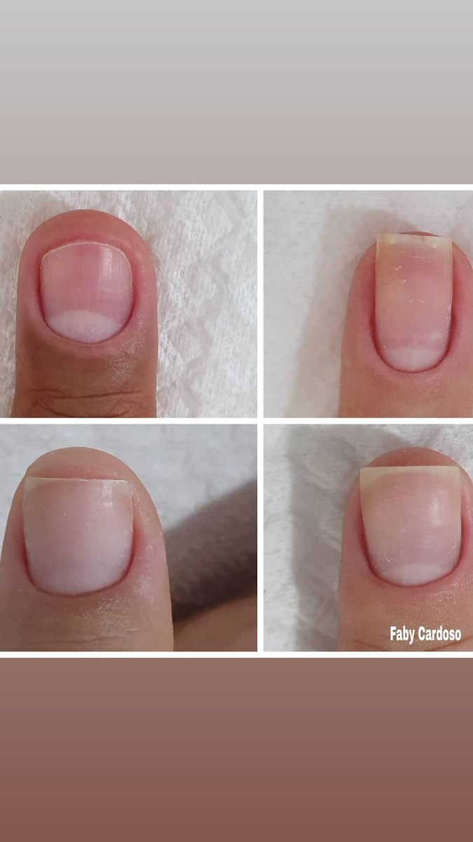 manicurso's tweet image. Rt galera 👉💅🙏
youtu.be/VKl1fPaVPiw