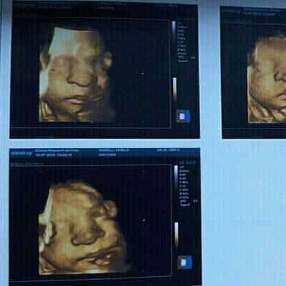 YamiiManelli's tweet photo. 👼Feliz cumpleaños al cielo, feliz primer añito princesita de mamá! 
El tiempo pasa rápido, el vacio en mi pecho no se va y mi corazon no sana.
Abrasos, caricias y besos guardados, sentimientos encontrados y un dolor insuperable. Jamas hubiera pensado en tener que despedirte, en+ https://t.co/6gZLvbpZJs