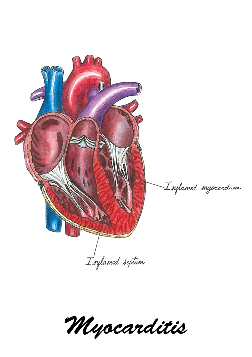 dundeeuni's tweet image. Do you ever find technical medical language confusing? Medical Art Student Karli Mogen’s Masters project relates heart conditions to common phrases, illustrating them to engage the public in anatomy. 

uod.ac.uk/2KWDEwQ

#djcadmastersshow