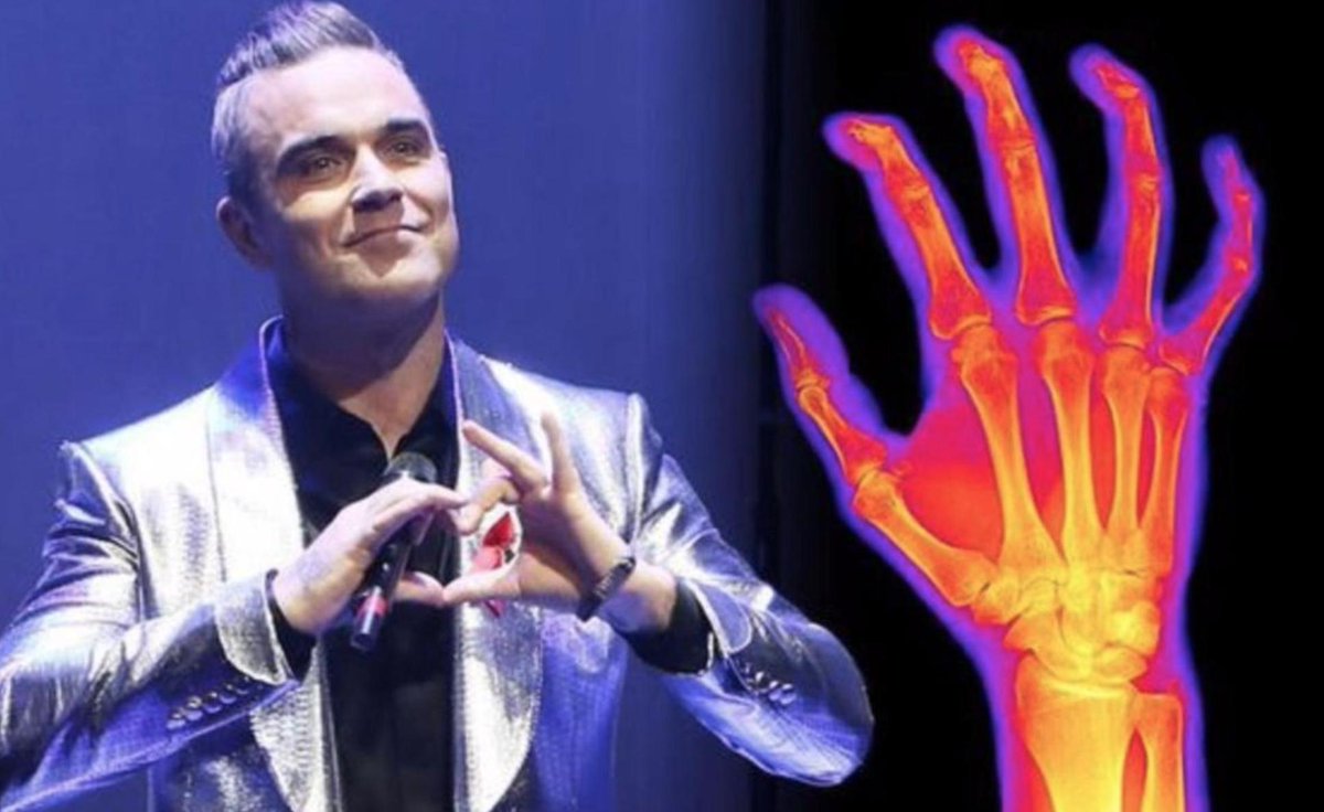 Arc4Health (@arc4_health) on Twitter photo Any of us could be affected by #arthritis, just ask <a href="/robbiewilliams/">Robbie Williams</a>.
Thank goodness we can rely on #Arc4Health for some relief. It's particularly good at treating arthritis #inflammation.🙏🏼
Have a look for yourself, it works - arc4health.com #VersusArthritis Any of us could be affected by #arthritis, just ask <a href="/robbiewilliams/">Robbie Williams</a>.
Thank goodness we can rely on #Arc4Health for some relief. It's particularly good at treating arthritis #inflammation.🙏🏼
Have a look for yourself, it works - arc4health.com #VersusArthritis