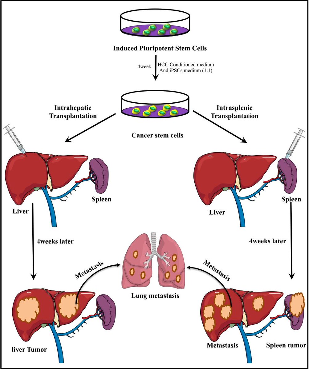 Bioeng_MDPI's tweet photo. "#Metastasis of #Cancer #Stem #Cells Developed in the #Microenvironment of Hepatocellular Carcinoma " by Dr. Masaharu Seno @Masaharu_Seno group.

https://t.co/O2rnRL9UsB https://t.co/UghaY8H5j0