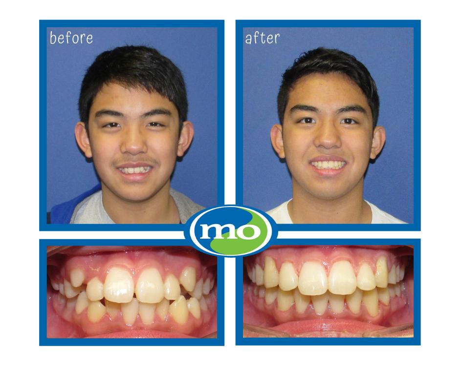 MOSmilz's tweet photo. Who doesn't love a good transformation photo?! Happy Friday! https://t.co/hTrhJ6GYGF
