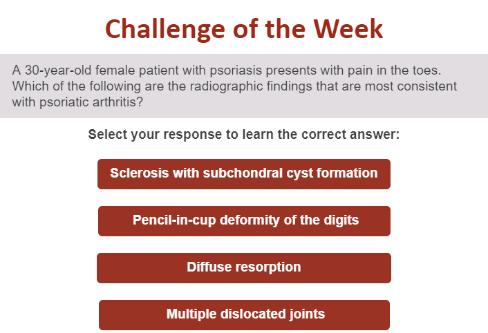 jbjs's tweet photo. Do you know the answer to the #JBJSClinicalClassroom Challenge of the Week?

Check your answer: https://t.co/DuISLqpGuU https://t.co/2cQy0BbPtu