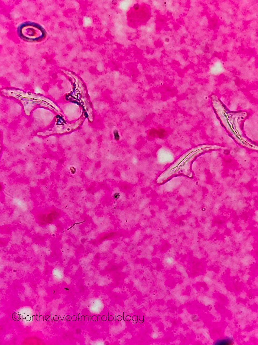 fortheloveofmi2's tweet photo. Hooklets of Echinococcus granulosus seen on a gram stain made from a liver abscess sample.

#microround #Microbiologypakistan #microbiology https://t.co/8hI1zIwhda