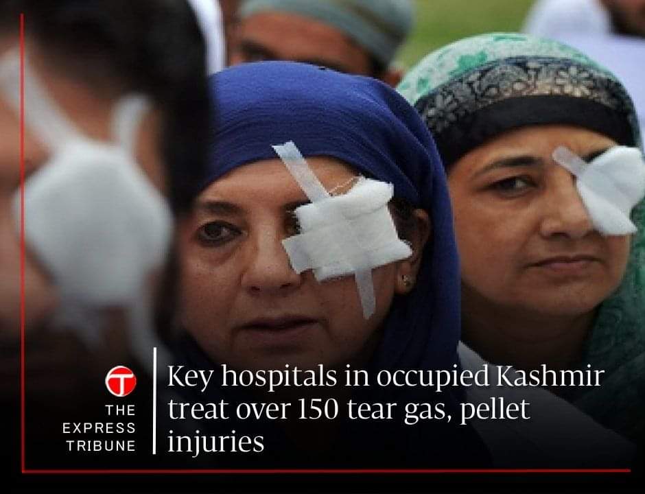 oyevivekk's tweet image. So they all got shot in the left eye? Now that&apos;s one hell of an aim!

I request the make up artists in #Kashmir to kindly do their work professionally, remember Pakistan media &amp;amp; #BBC is counting on you.

#KashmirProtests