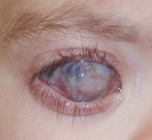 blind_vi tweet picture