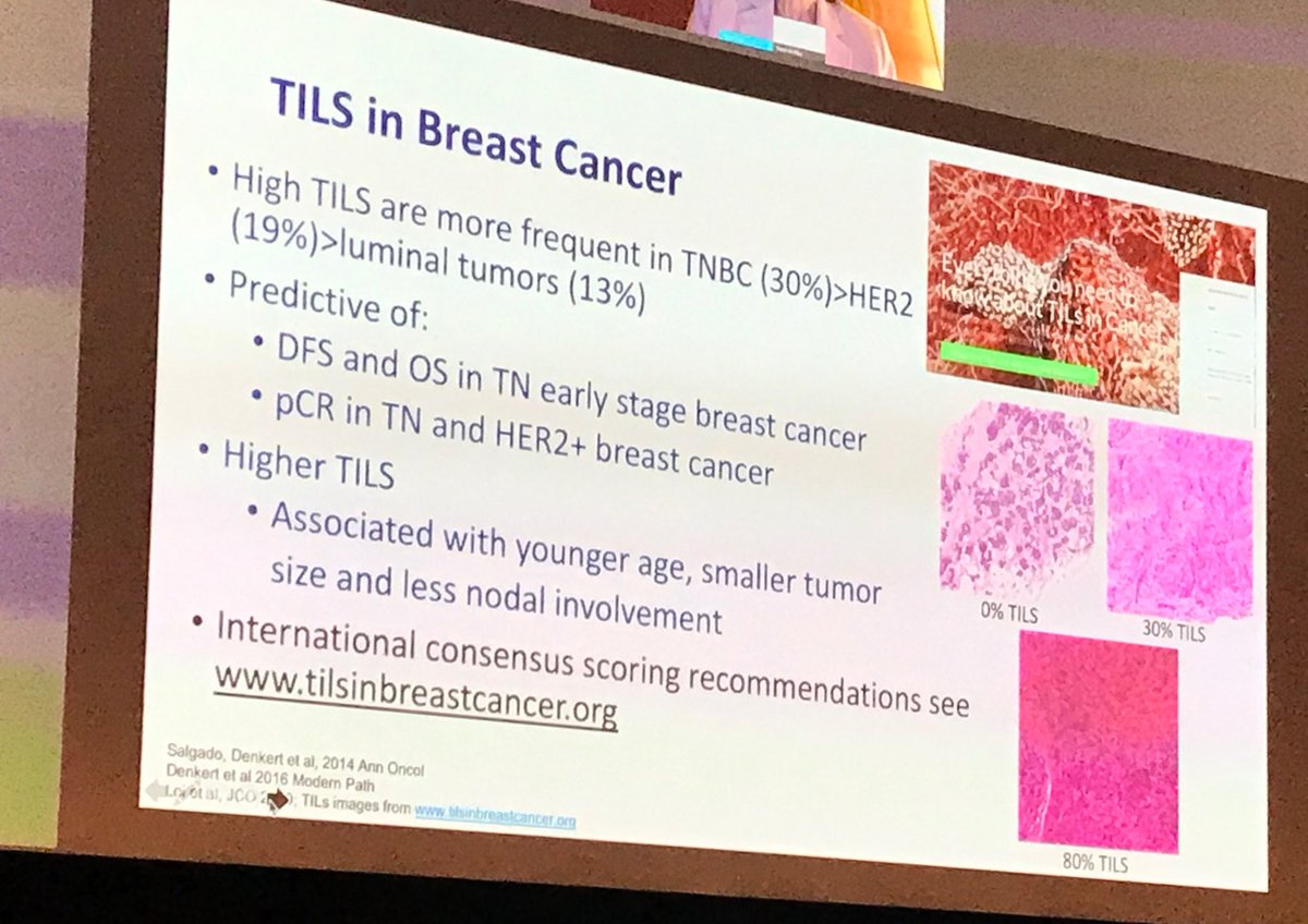 jamecancerdoc's tweet photo. Outstanding discussion on #Immunotherapy for #breastcancer by ⁦@hoperugo⁩ ⁦@ClevelandClinic⁩ #CleClinicCancer https://t.co/G2RHxxXmSY