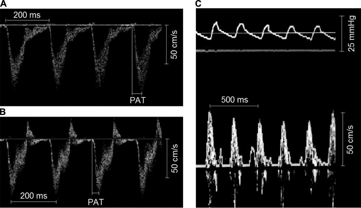 free multivariate density estimation