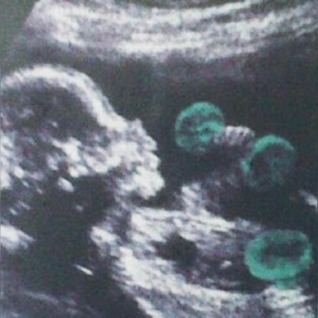 RISE N GRIND! God has blessed me with another year on this earth. As you can see from my 1960's sonogram,I was in GRINDMODE 💪 before I came out of the womb. 😂#thankful #humbled #BirthdayBoy #GodStrong #AMDG #BomberStrength