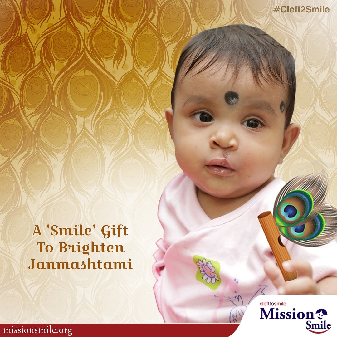 MissionSmileInd's tweet photo. Celebrate this #Janmashtami in a meaningful way. Donate to Mission Smile for transforming lives: https://t.co/LQFKr5xNFB

#HareKrishna #MissionSmile #Cleft2Smile https://t.co/7cZTM1vVYF