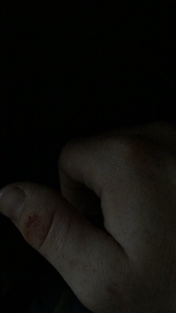 Tandrewskii's tweet photo. Just knocked a dude out cold 😂😂🤘🏽 https://t.co/S42GpeFnkO