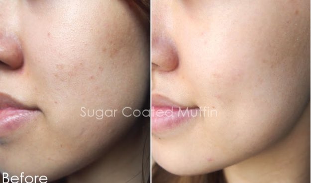 PinkishhS's tweet photo. 🌼พร้อมส่ง Kiehl’s Clearly Corrective Dark Spot Solution ตัวดัง ของแท้1000000%
➖เซรั่มช่วยปรับสีผิวให้สม่ำเสมอ ลดเลือนจุดด่างดำ รอยดำรอยแดงจากสิว อย่างมีประสิทธิภาพ เห็นผลรวดเร็วภายใน 2 สัปดาห์
ขนาด 4 ml 280฿
ขนาด 50 ml 2700฿
#howtoperpect #สกินแคร์รักษาสิว #Kiehls #รอยสิว https://t.co/xfufrh5WBZ