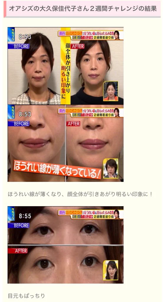 ほうれい線は10歳も老けて見えちゃう…しっかり顔のマッサージしよう！！
