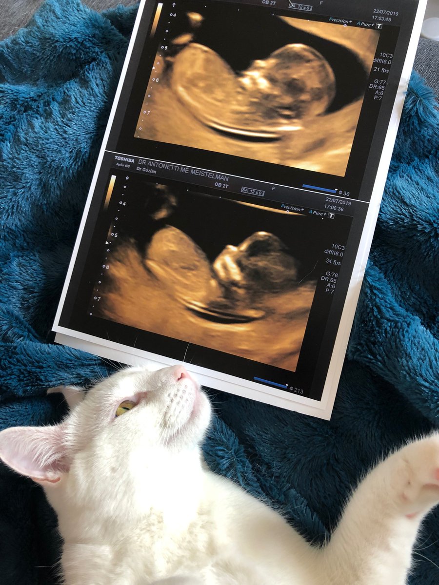 Beau dimanche à vous aussi 🐱👶❤️