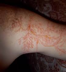 RapPlanetHQ's tweet photo. @just1Rebel @dingusmj @buckslevito @BenjaminEnfield Lightning tends to permanently scar everything it touches. You got life! https://t.co/4Z9OikJpRj