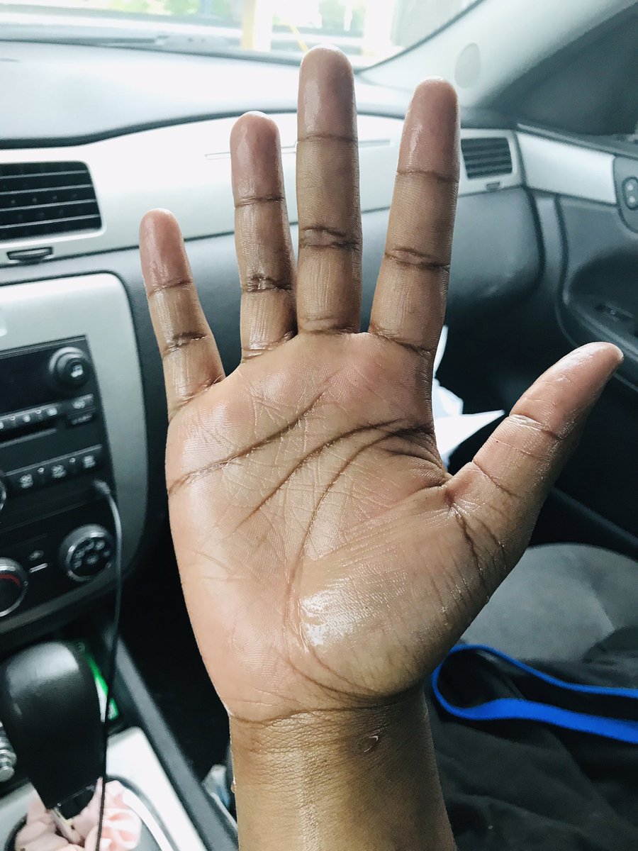 i_reasons's tweet image. #Hyperhydrosis