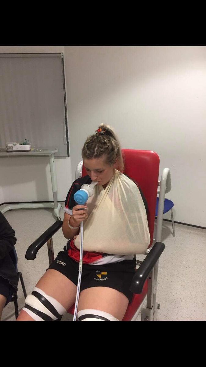 StaceyLouise93's tweet image. Not quite how I planned starting off the season... 🙈 #dislocated #rugby #shoulder