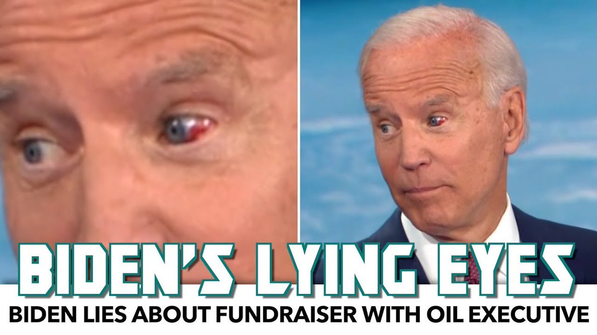 Left wing The Hill: Don't bash Biden poor health, bloody eye was barely noticable!