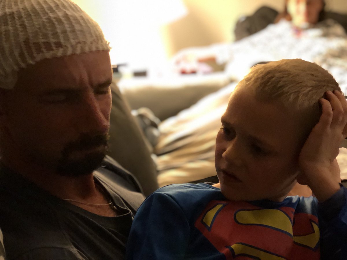 AmandaPitzo's tweet photo. #Superman #Glioblastoma #Novucure #optune #braincancer #Joy #livelovelaugh https://t.co/9yWH6vqlpw