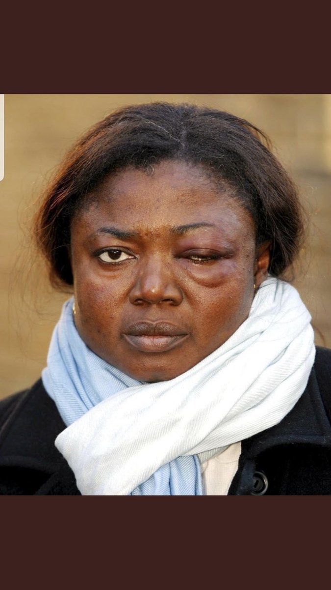 Truth48342475's tweet image. #10YearsOfCheryl
But do people remember what she did to this poor woman? 
She was convicted of attacking a toilet attendant and all the punishment she had was to sand-paper benches at a local football club as punishment #systemiscorrupt @CherylOfficial