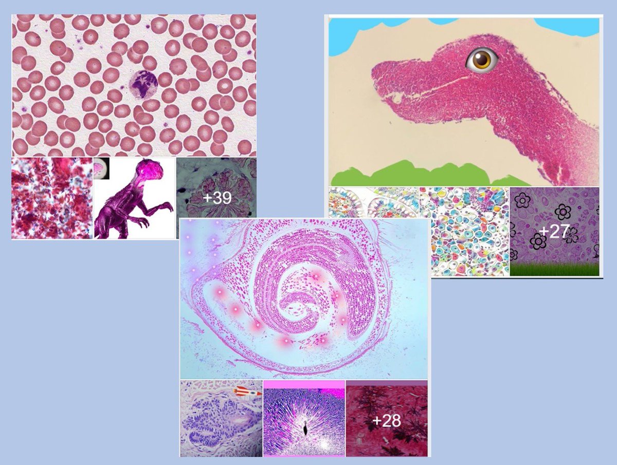 TurkJPath's tweet photo. Welcome to the 3rd International #PathArt Photo Contest with 50 participants from 16 different countries organized by @Turk_J_Path  and @PatoDernFed

Please click on the following link, and vote for your favorite photos: https://t.co/zytuvP2TTY

#TCPTrabzon2019 #TurkPath https://t.co/73XEkOIg9F