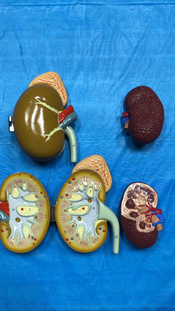 nephondemand's tweet image. At the annual @BAPSCharities health fair in Charlotte &amp;amp; getting good use of the kidney models to educate patients about CKD &amp;amp; other Renal-diseases #baps 
Share a pic of your favorite #kidneymodel by replying (use the hashtag #kidneymodel ) (looking for the most educational ones)