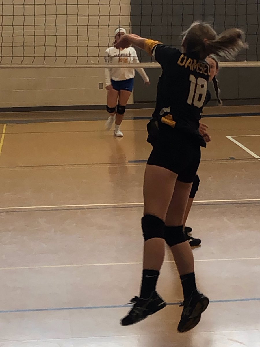 4 months after spinal fusion surgery and <a href="/bpedmo/">bpedmo</a> is going strong!
#shrinersphilly #scoliosis #volleyball