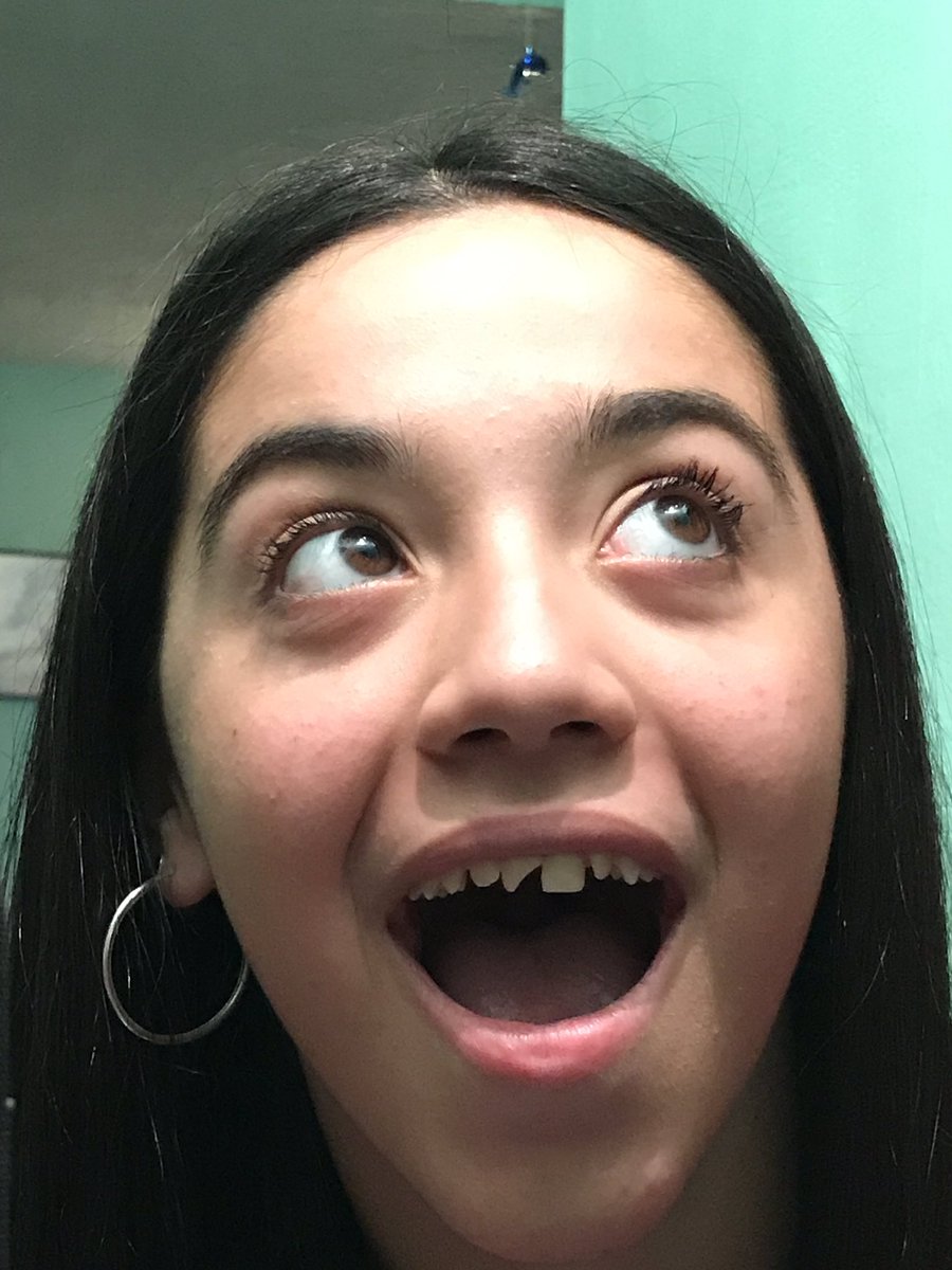 Angiecastagn0's tweet photo. Rt para que no se te quiebre el diente como a mi amiga https://t.co/caKY1YCku4