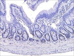 EPLinc's tweet image. EPL offers high quality immunohistochemical staining services using standard protocols developed in-house or transferred from the client. buff.ly/2IuJqUH