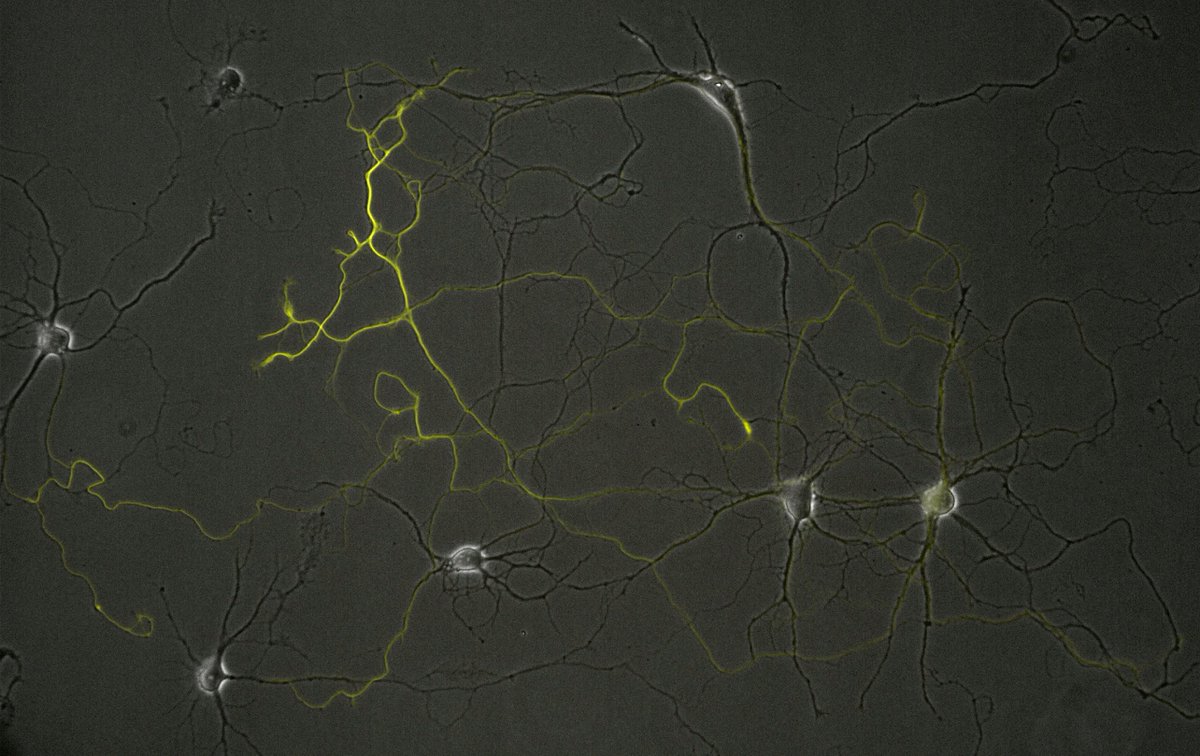 Misono_Lab's tweet image. Tau lacking the microtubule-binding domain/repeats diffuses almost freely and can still localize to the axon.... #neuroscience #CellBiology