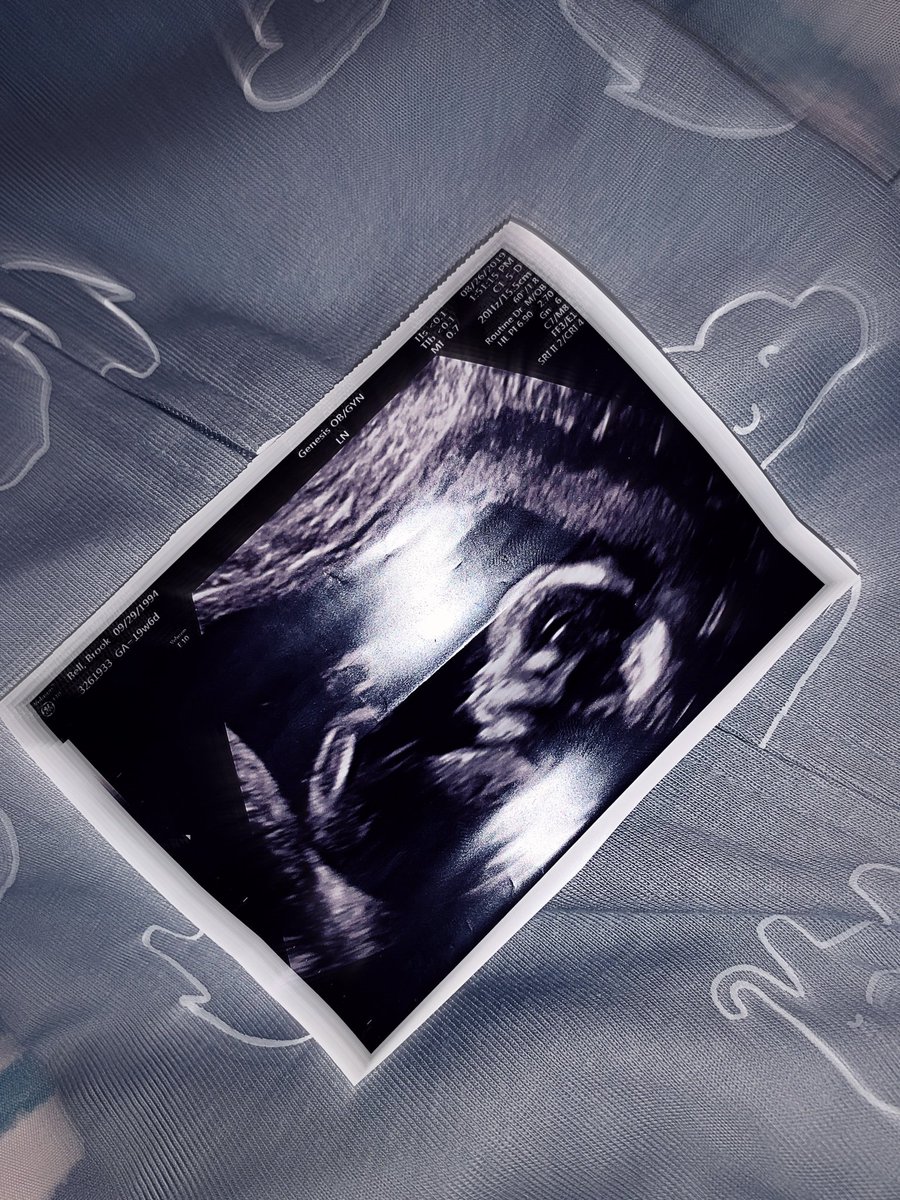 BLovee_'s tweet photo. We have been blessed with another boy 💙 https://t.co/9coiDyhP55